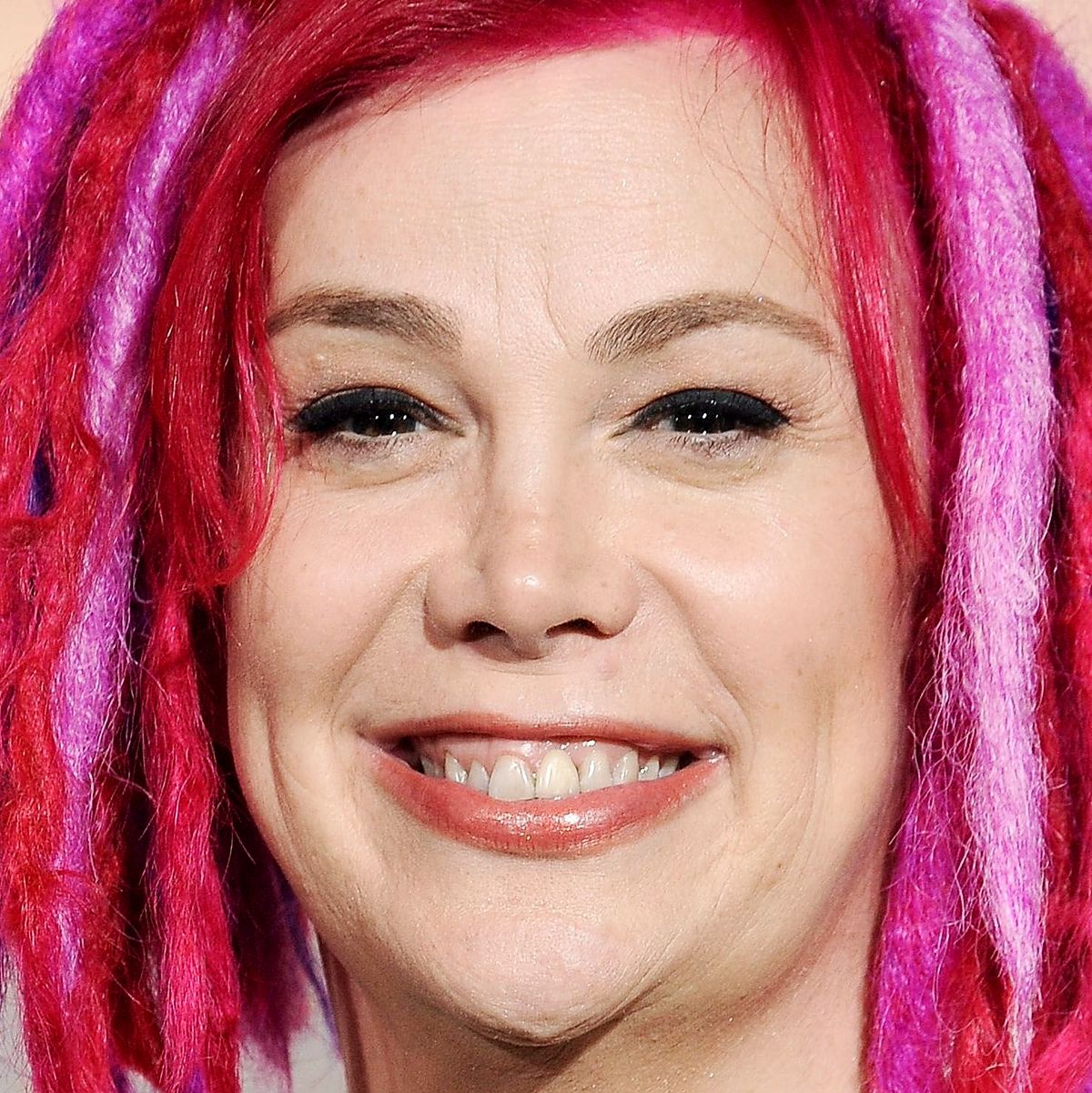 Лана Вачовски после операции